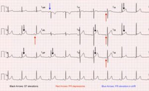 Creative Commons images