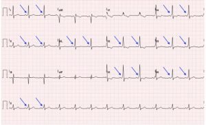 Creative Commons images