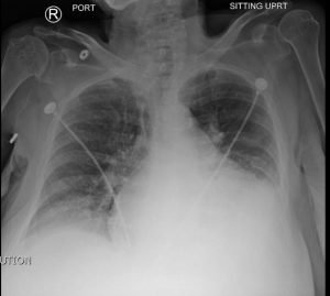 Creative Commons images