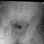 Creative Commons images