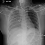 Creative Commons images