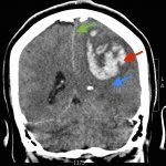 Creative Commons images