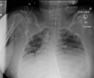 Creative Commons images