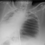 Creative Commons images