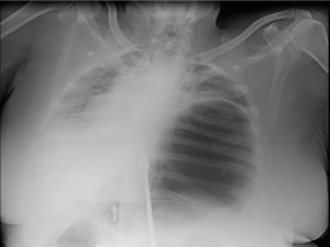 Creative Commons images