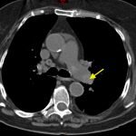 Creative Commons images