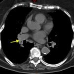 Creative Commons images