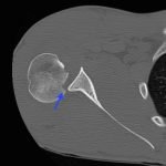 Creative Commons images