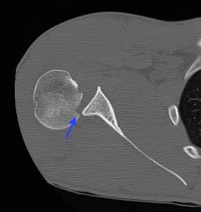 Creative Commons images