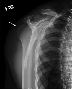 Creative Commons images