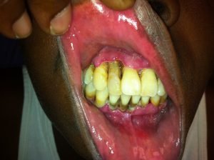 Creative Commons images