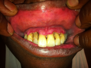 Creative Commons images