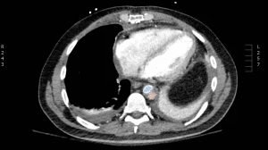 Creative Commons images