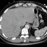 Creative Commons images