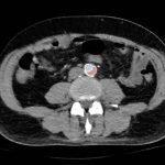 Creative Commons images