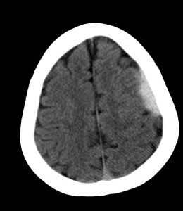 Creative Commons images