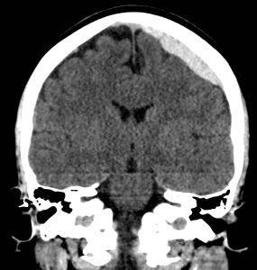 Creative Commons images