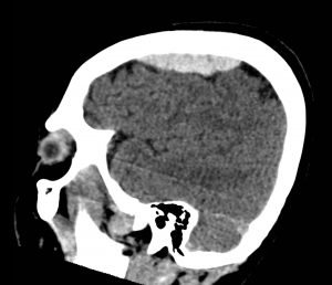 Creative Commons images