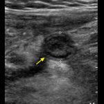 Creative Commons images