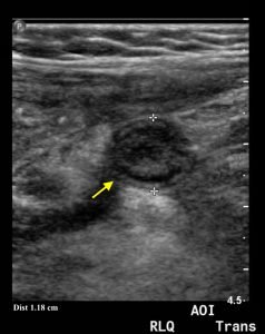 Creative Commons images