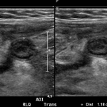 Creative Commons images