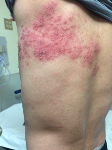 Creative Commons images