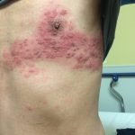 Creative Commons images