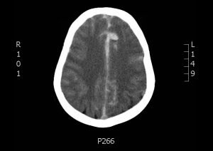 Creative Commons images