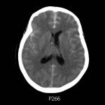 Creative Commons images