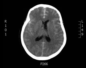 Creative Commons images