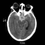 Creative Commons images