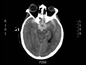 Creative Commons images