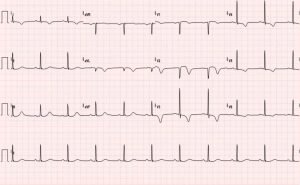 Creative Commons images