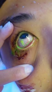 Creative Commons images