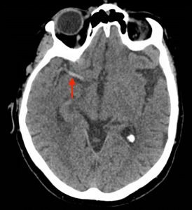 Creative Commons images