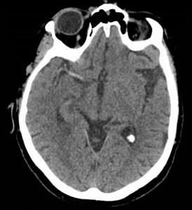 Creative Commons images