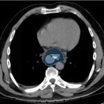 Creative Commons images