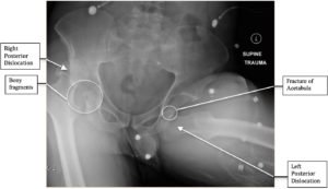 Creative Commons images