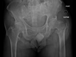 Creative Commons images