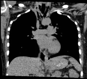 Creative Commons images