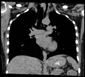 Creative Commons images