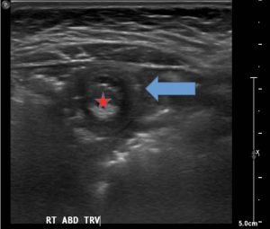 Creative Commons images