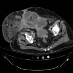 Creative Commons images