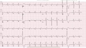 Creative Commons images