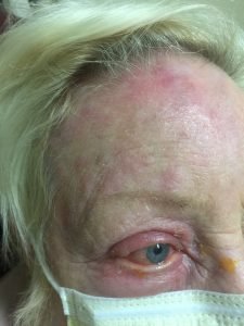 Creative Commons images