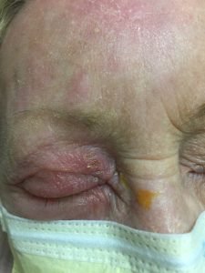 Creative Commons images