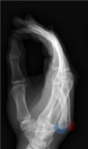 Creative Commons images