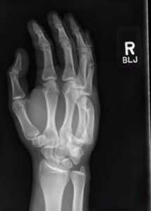 Creative Commons images