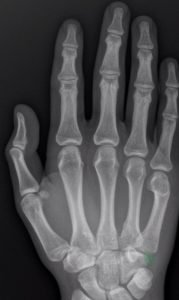 Creative Commons images