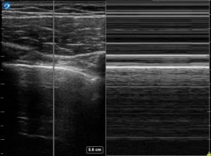 Creative Commons images